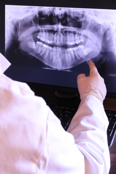 Best Emergency Wisdom Teeth Removal in Midlothian, IL