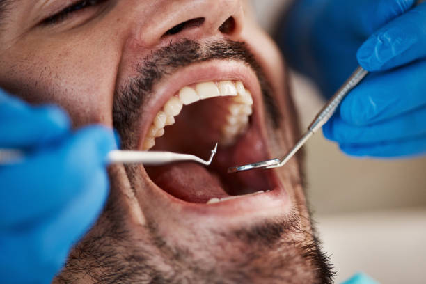 Best Emergency Root Canal Treatment in Midlothian, IL