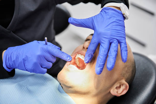 Best Emergency Gum Treatment in Midlothian, IL