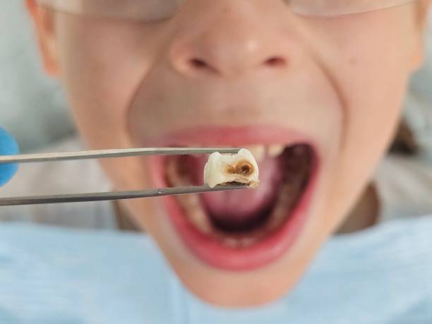 Best Urgent Care for Lost Fillings or Crowns in Midlothian, IL